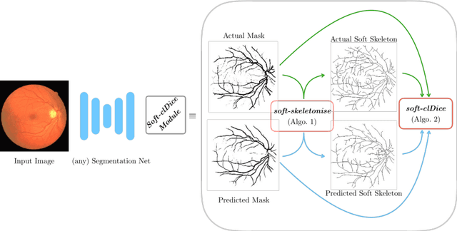 Figure 3 for clDice -- a Topology-Preserving Loss Function for Tubular Structure Segmentation