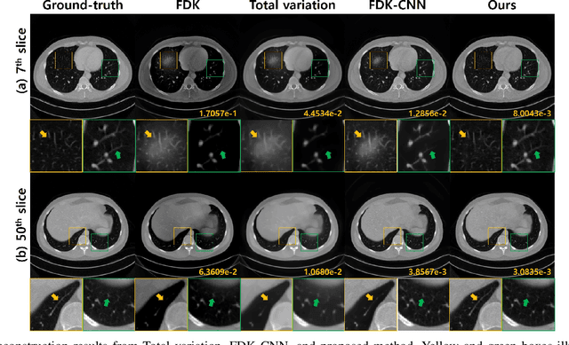 Figure 4 for Differentiated Backprojection Domain Deep Learning for Conebeam Artifact Removal