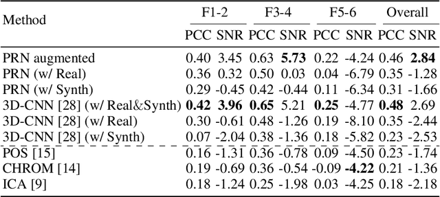 Figure 4 for Overcoming Difficulty in Obtaining Dark-skinned Subjects for Remote-PPG by Synthetic Augmentation