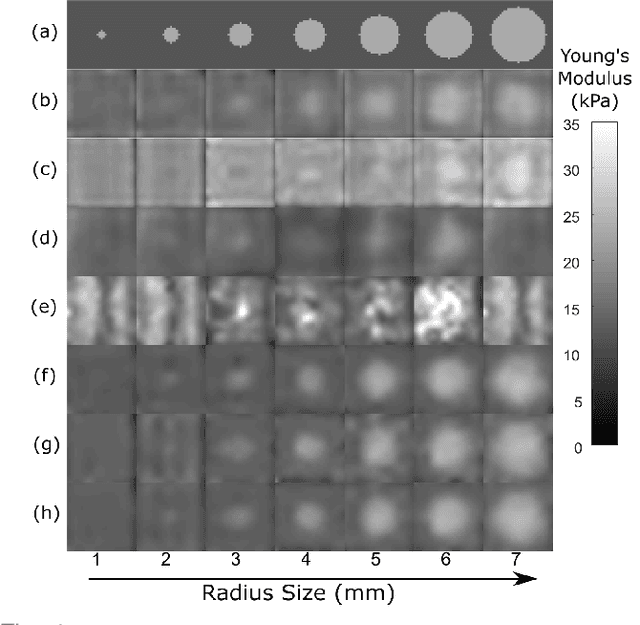 Figure 4 for Multifrequency 3D Elasticity Reconstruction withStructured Sparsity and ADMM