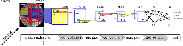 Figure 3 for Automatic Classification of Cancerous Tissue in Laserendomicroscopy Images of the Oral Cavity using Deep Learning