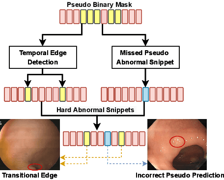 Figure 3 for Contrastive Transformer-based Multiple Instance Learning for Weakly Supervised Polyp Frame Detection