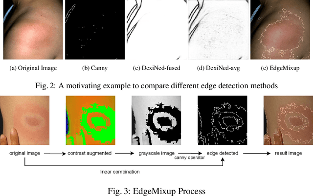 Figure 4 for EdgeMixup: Improving Fairness for Skin Disease Classification and Segmentation