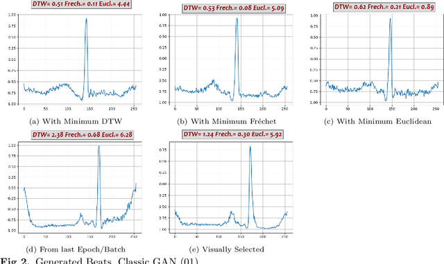 Figure 4 for Synthetic ECG Signal Generation Using Generative Neural Networks