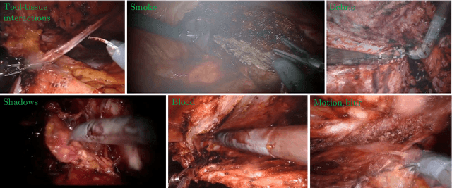 Figure 2 for Image Compositing for Segmentation of Surgical Tools without Manual Annotations