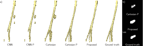 Figure 4 for Learning Shape Representation on Sparse Point Clouds for Volumetric Image Segmentation