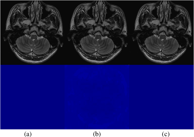 Figure 2 for Variable Augmented Network for Invertible MR Coil Compression