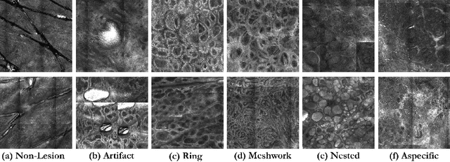 Figure 1 for A Multiresolution Convolutional Neural Network with Partial Label Training for Annotating Reflectance Confocal Microscopy Images of Skin