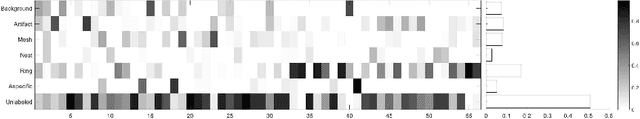 Figure 4 for A Multiresolution Convolutional Neural Network with Partial Label Training for Annotating Reflectance Confocal Microscopy Images of Skin