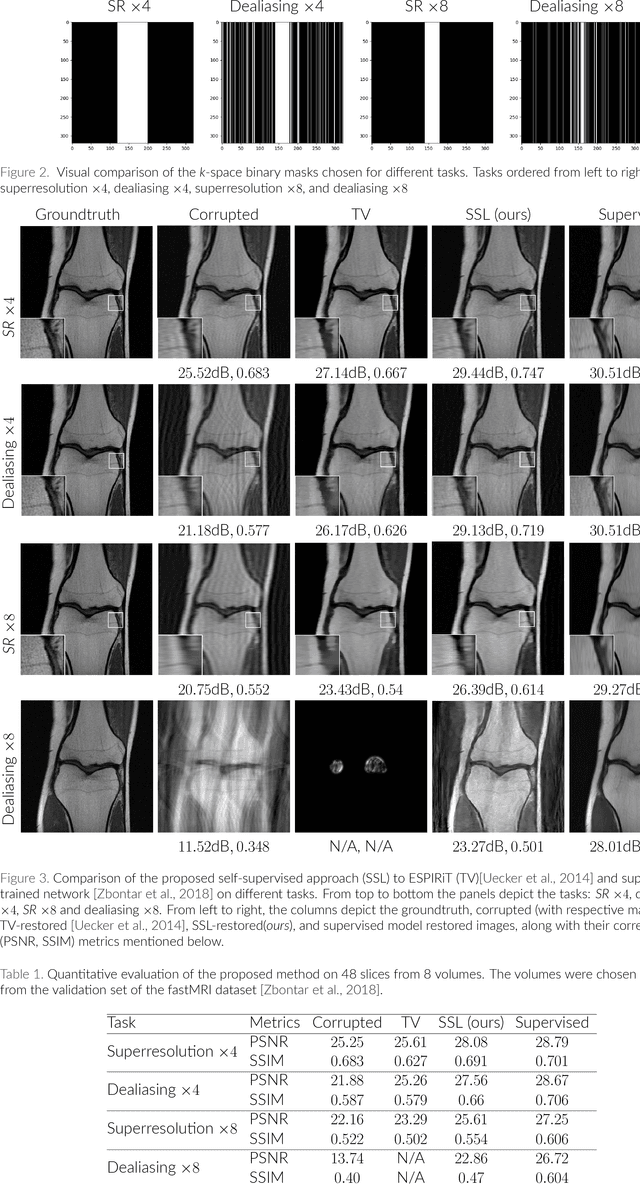 Figure 2 for Self-supervised learning of inverse problem solvers in medical imaging