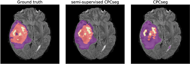 Figure 4 for Label-Efficient Multi-Task Segmentation using Contrastive Learning