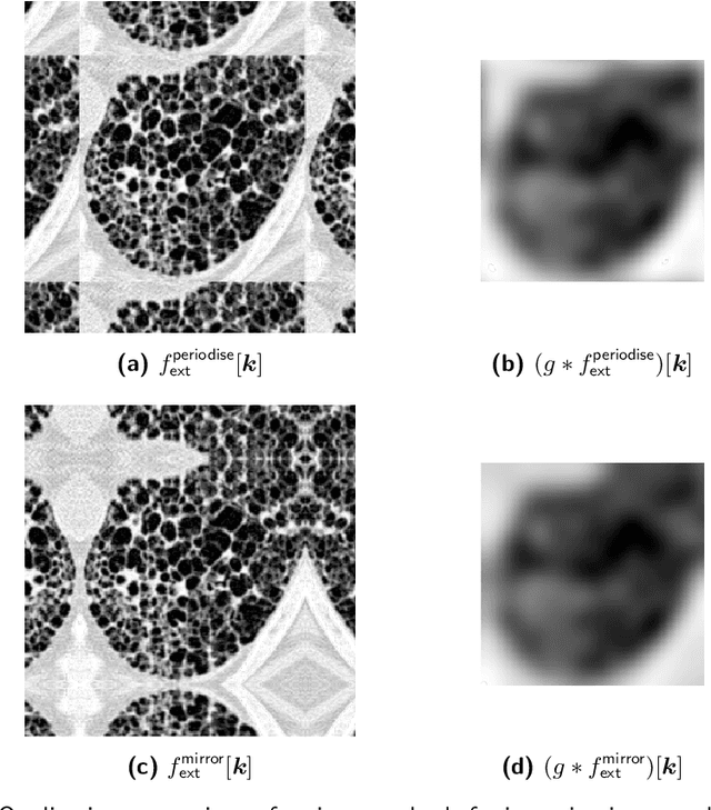Figure 4 for Standardised convolutional filtering for radiomics