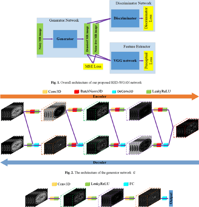 Figure 1 for Denoising of 3-D Magnetic Resonance Images Using a Residual Encoder-Decoder Wasserstein Generative Adversarial Network