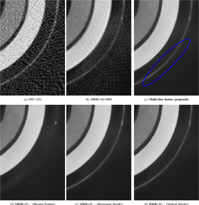 Figure 2 for Multi-Slice Fusion for Sparse-View and Limited-Angle 4D CT Reconstruction