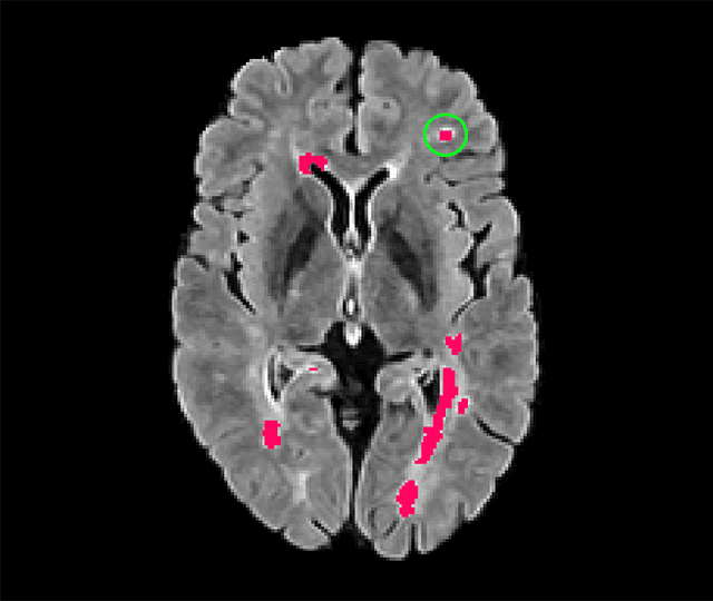 Figure 1 for blob loss: instance imbalance aware loss functions for semantic segmentation