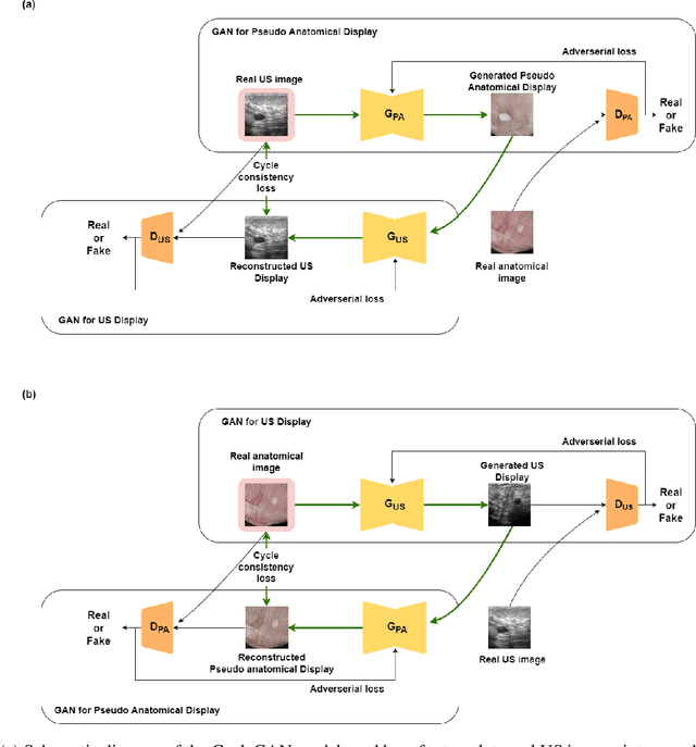 Figure 1 for Image translation of Ultrasound to Pseudo Anatomical Display Using Artificial Intelligence