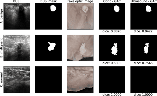 Figure 3 for Image translation of Ultrasound to Pseudo Anatomical Display Using Artificial Intelligence