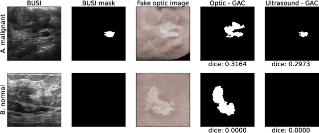 Figure 4 for Image translation of Ultrasound to Pseudo Anatomical Display Using Artificial Intelligence