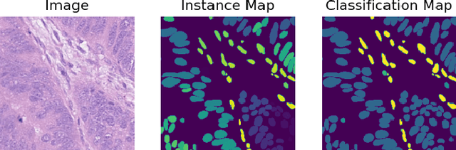 Figure 1 for MF-Hovernet: An Extension of Hovernet for Colon Nuclei Identification and Counting  Challenge