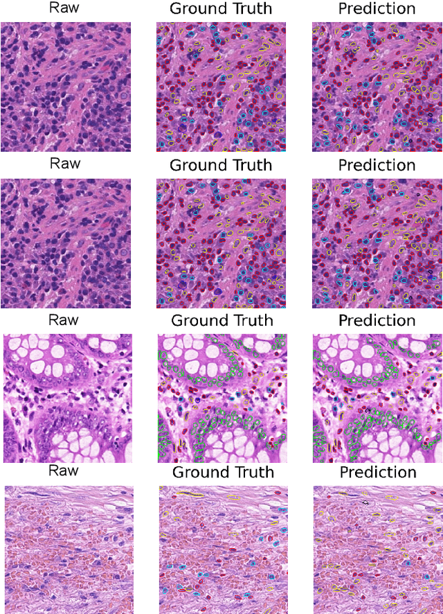 Figure 3 for MF-Hovernet: An Extension of Hovernet for Colon Nuclei Identification and Counting  Challenge
