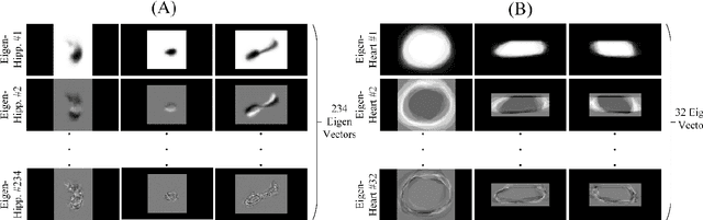 Figure 3 for A novel shape-based loss function for machine learning-based seminal organ segmentation in medical imaging