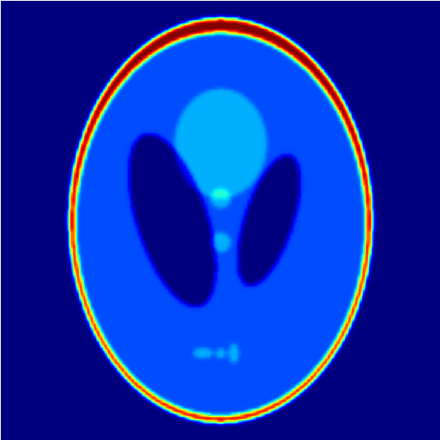 Figure 3 for SPECT Angle Interpolation Based on Deep Learning Methodologies