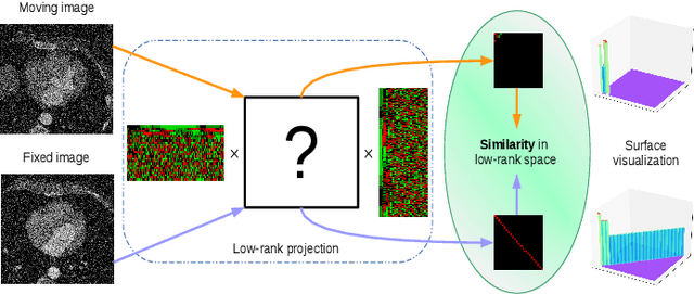 Figure 1 for A low-rank representation for unsupervised registration of medical images