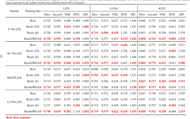Figure 4 for Free-form tumor synthesis in computed tomography images via richer generative adversarial network