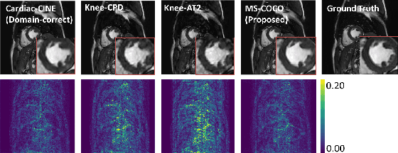 Figure 2 for Generalising Deep Learning MRI Reconstruction across Different Domains