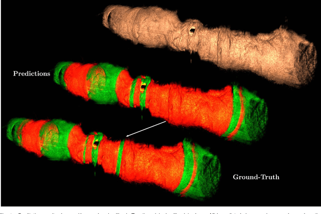 Figure 4 for Automatic Plaque Detection in IVOCT Pullbacks Using Convolutional Neural Networks