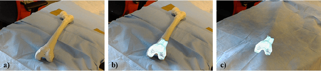 Figure 3 for Closing the Calibration Loop: An Inside-out-tracking Paradigm for Augmented Reality in Orthopedic Surgery