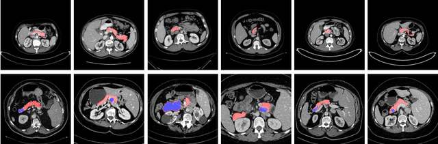 Figure 1 for Volumetric Medical Image Segmentation: A 3D Deep Coarse-to-fine Framework and Its Adversarial Examples