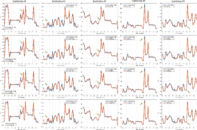 Figure 3 for Hypernetwork-based Personalized Federated Learning for Multi-Institutional CT Imaging