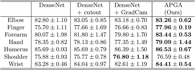 Figure 2 for Adversarial Policy Gradient for Deep Learning Image Augmentation