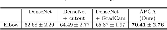 Figure 3 for Adversarial Policy Gradient for Deep Learning Image Augmentation
