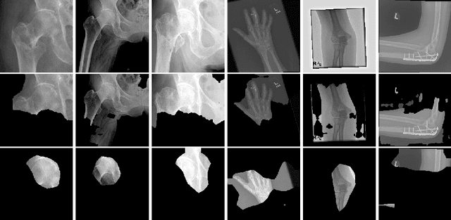 Figure 4 for Adversarial Policy Gradient for Deep Learning Image Augmentation
