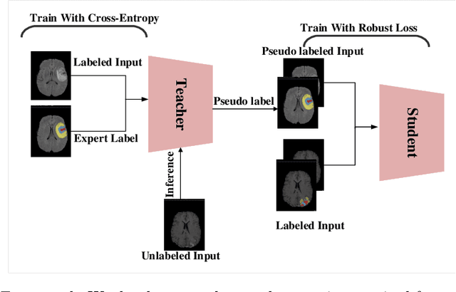 Figure 1 for Semi-supervised Learning using Robust Loss