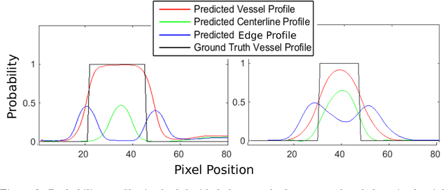 Figure 3 for A Recursive Bayesian Approach To Describe Retinal Vasculature Geometry