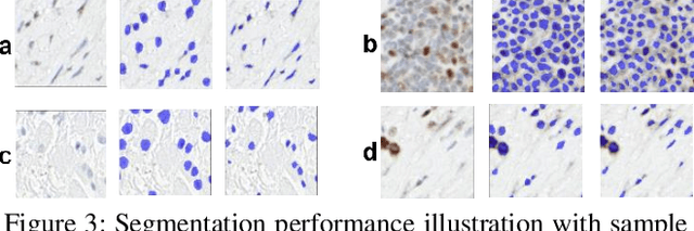 Figure 4 for Weakly Supervised Multi-Task Learning for Cell Detection and Segmentation