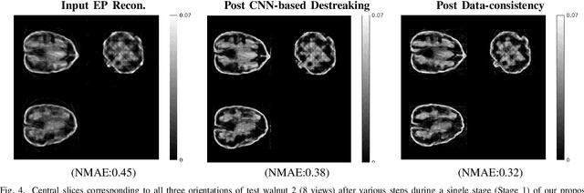 Figure 4 for Sparse-view Cone Beam CT Reconstruction using Data-consistent Supervised and Adversarial Learning from Scarce Training Data