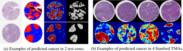 Figure 2 for A Deep Learning Framework for Automatic Diagnosis in Lung Cancer