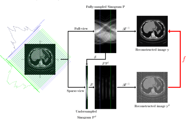 Figure 3 for Framelet Pooling Aided Deep Learning Network : The Method to Process High Dimensional Medical Data