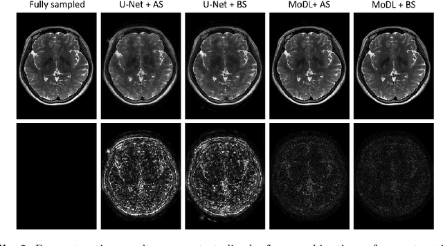 Figure 2 for Extending LOUPE for K-space Under-sampling Pattern Optimization in Multi-coil MRI