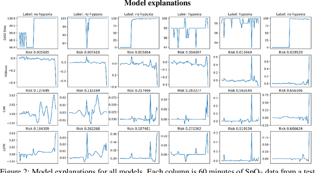 Figure 2 for Anesthesiologist-level forecasting of hypoxemia with only SpO2 data using deep learning