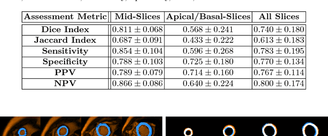 Figure 2 for Integrating Atlas and Graph Cut Methods for LV Segmentation from Cardiac Cine MRI