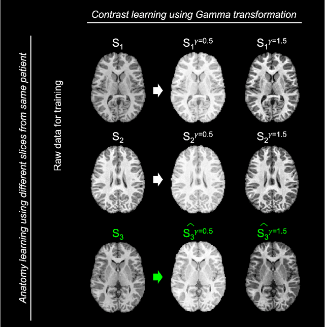 Figure 3 for ImUnity: a generalizable VAE-GAN solution for multicenter MR image harmonization