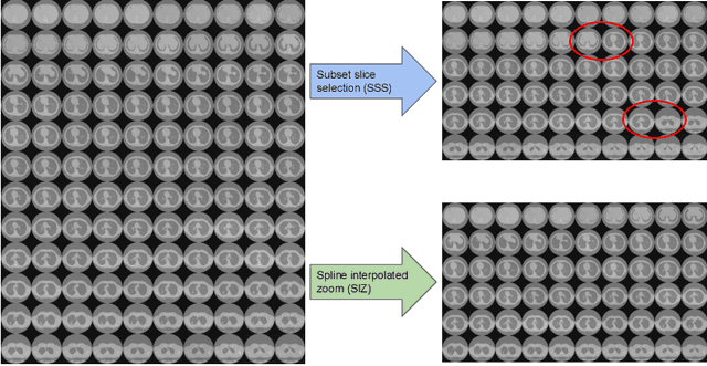 Figure 1 for Uniformizing Techniques to Process CT scans with 3D CNNs for Tuberculosis Prediction
