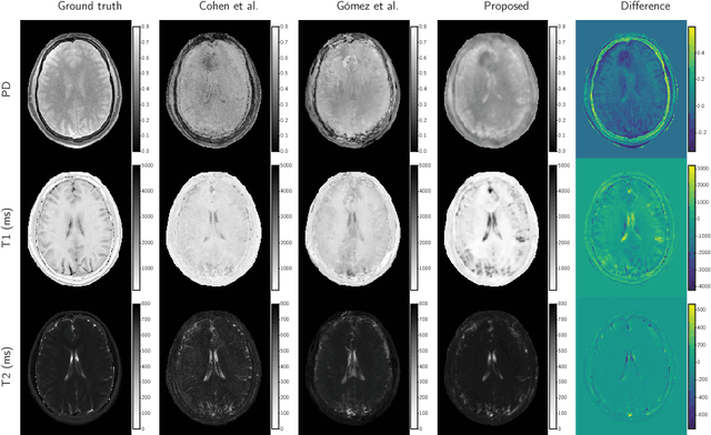Figure 4 for Magnetic Resonance Fingerprinting Reconstruction via Spatiotemporal Convolutional Neural Networks