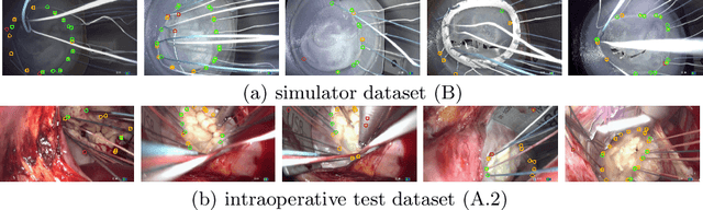 Figure 2 for Heatmap-based 2D Landmark Detection with a Varying Number of Landmarks