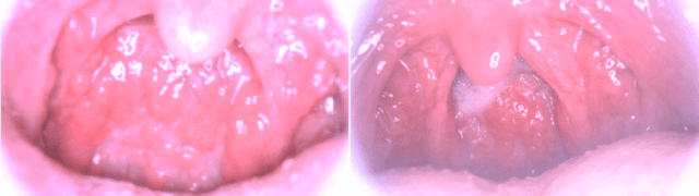 Figure 1 for MIINet: An Image Quality Improvement Framework for Supporting Medical Diagnosis